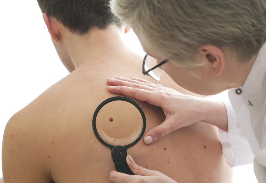 Popular Misconceptions About Skin Cancer Debunked